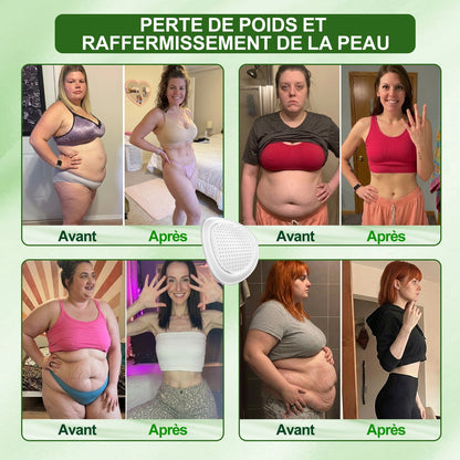 80% OFF Offer 🇫🇷 𝐃𝐑.𝐇𝐎𝐍𝐎𝐑® 𝐏𝐚𝐭𝐜𝐡 𝐀𝐦𝐢𝐧𝐜𝐢𝐬𝐬𝐚𝐧𝐭 𝐍𝐚𝐧𝐨-𝐌𝐢𝐜𝐫𝐨𝐧𝐞𝐞𝐝𝐥𝐞 𝐃𝐫𝐚𝐢𝐧𝐚𝐠𝐞 𝐋𝐲𝐦𝐩𝐡𝐚𝐭𝐢𝐪𝐮𝐞 : 𝐅𝐨𝐫𝐦𝐮𝐥𝐞 𝐔𝐥𝐭𝐫𝐚-𝐏𝐮𝐢𝐬𝐬𝐚𝐧𝐭𝐞 𝟓× 𝐚𝐯𝐞𝐜 𝐂𝐨𝐦𝐩𝐥𝐞𝐱𝐞 𝐏𝐞𝐩𝐭𝐢𝐝𝐢𝐪𝐮𝐞 𝐋𝐢𝐩𝐨𝐥𝐲𝐭𝐢𝐪𝐮𝐞, 𝐩𝐨𝐮𝐫 𝐥𝐚 𝐩𝐞𝐫𝐭𝐞 𝐝𝐞 𝐩𝐨𝐢𝐝𝐬, 𝐥𝐞𝐬 𝐚𝐫𝐭𝐢𝐜𝐮𝐥𝐚𝐭𝐢𝐨𝐧𝐬, 𝐥𝐞 𝐬𝐨𝐦𝐦𝐞𝐢𝐥 𝐞𝐭 𝐥’𝐚𝐮𝐠𝐦𝐞𝐧𝐭𝐚𝐭𝐢𝐨𝐧 𝐝𝐞 𝐥’é𝐧𝐞𝐫𝐠𝐢𝐞.